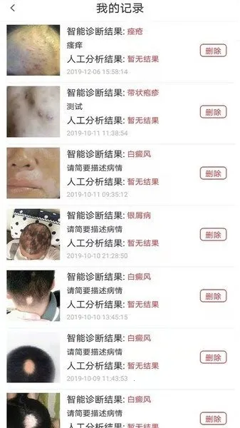 Ƥ�������ѡҩ2025���°汾